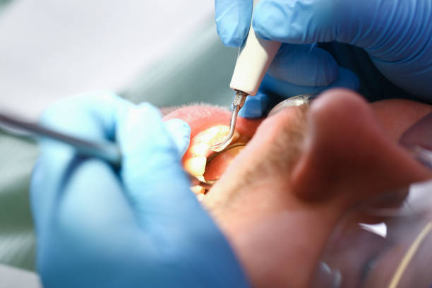 Best Emergency Broken Tooth Repair in Fircrest, WA