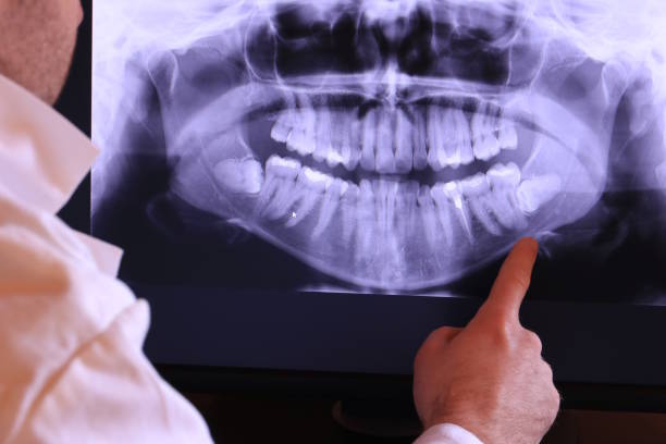 Best Emergency Treatment for Toothache in Fircrest, WA