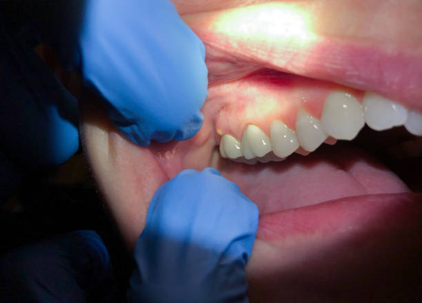 Best Pediatric Emergency Dentist in Fircrest, WA