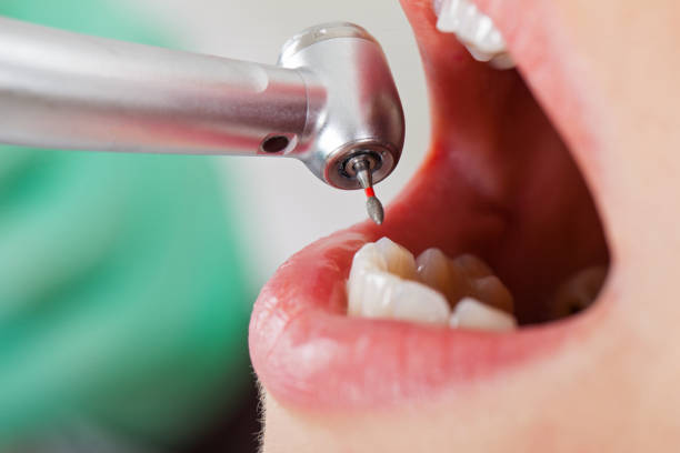 Best After-Hours Emergency Dentist in Fircrest, WA